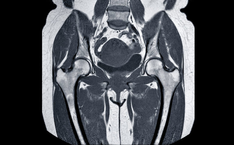 Risonanza Magnetica Bacino Medical Imaging Caserta