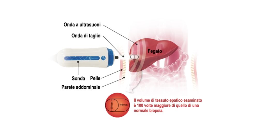 Come funziona il FirocTouch